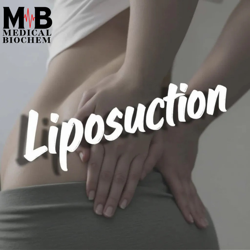 Liposuction